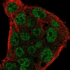Anti-SOCS1 Antibody