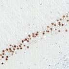 Immunohistochemical staining of rat hippocampus shows moderate to strong nuclear positivity in CA1 layer neurons.