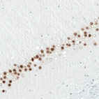 Immunohistochemical staining of rat hippocampus shows moderate to strong nuclear positivity in CA1 layer neurons.