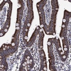Anti-RCE1 Antibody