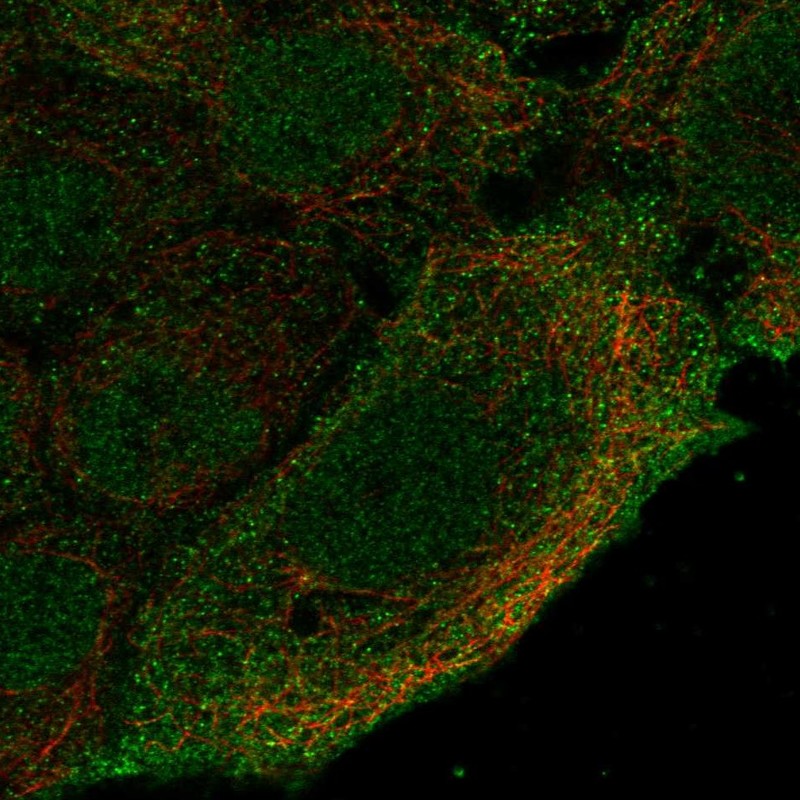 Anti-CNGA4 Antibody
