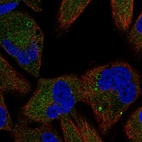 Anti-TSC1 Antibody