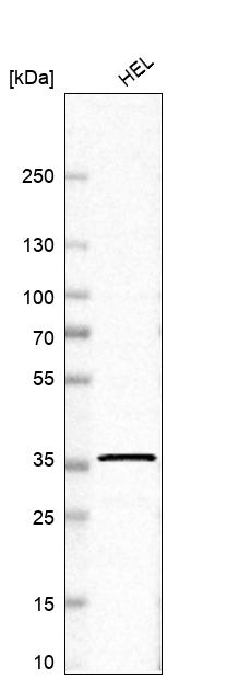 Anti-RNF34 Antibody