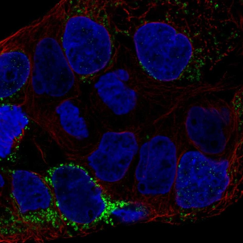 Anti-CLN6 Antibody