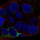 Anti-CLN6 Antibody