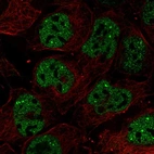 Immunofluorescent staining of human cell line CACO-2 shows localization to nuclear bodies.