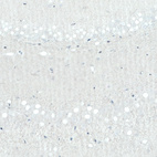 Immunohistochemical staining of rat hippocampus shows no positivity in neurons in the dentate gyrus as expected.