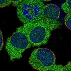 Immunofluorescent staining of human cell line HEL shows localization to cytosol.