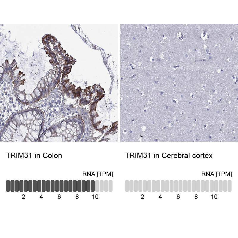 Anti-TRIM31 Antibody