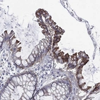 Immunohistochemical staining of human colon shows high expression.