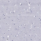 Immunohistochemical staining of human cerebral cortex shows low expression as expected.