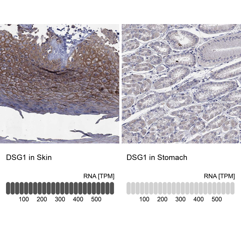Anti-DSG1 Antibody