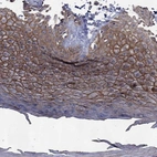 Immunohistochemical staining of human skin shows high expression.