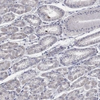Immunohistochemical staining of human stomach shows low expression as expected.