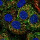 Anti-PLA2G4D Antibody