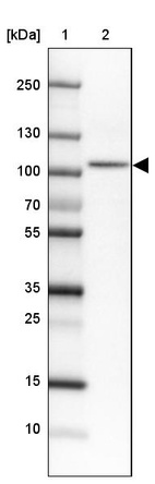 Lane 1: Marker [kDa]_br/_Lane 2: Human cell line HEL