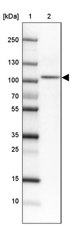 Lane 1: Marker [kDa]_br/_Lane 2: Human cell line HEL