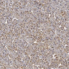 Anti-CAPN15 Antibody
