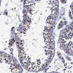Anti-GALNS Antibody
