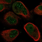 Immunofluorescent staining of human cell line PC-3 shows localization to nuclear bodies.