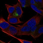 Immunofluorescent staining of human cell line SH-SY5Y shows localization to cytosol.