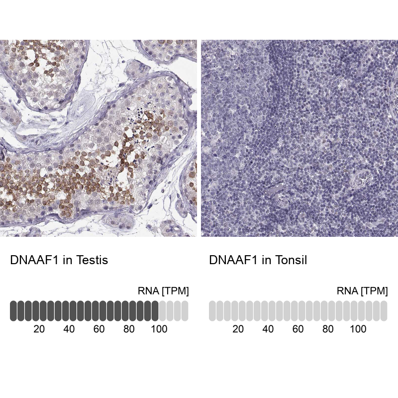 Anti-DNAAF1 Antibody
