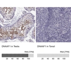 Anti-DNAAF1 Antibody