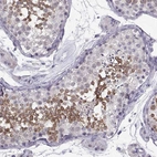Immunohistochemical staining of human testis shows strong cytoplasmic positivity in cells in seminiferous ducts.