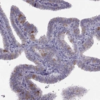 Immunohistochemical staining of human fallopian tube shows moderate cytoplasmic positivity in glandular cells.