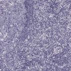 Immunohistochemical staining of human tonsil shows negative cytoplasmic positivity in non-germinal center cells and germinal center cells as expected.
