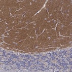 Anti-SYT12 Antibody
