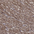 Anti-PDE3A Antibody