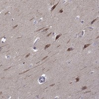 Anti-B3GAT1 Antibody