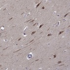 Anti-B3GAT1 Antibody