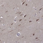 Anti-B3GAT1 Antibody