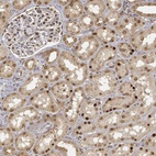 Anti-CIB1 Antibody