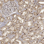 Anti-CIB1 Antibody