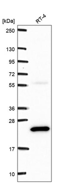 Western blot analysis in human cell line RT-4.