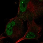 Anti-POLR3G Antibody