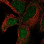Anti-UBE2R2 Antibody