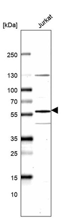 Anti-KAT5 Antibody