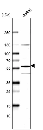 Anti-KAT5 Antibody
