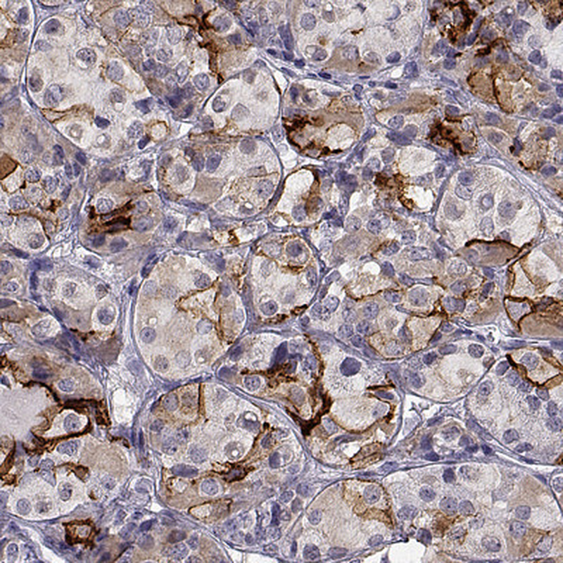 Anti-TGFBR3L Antibody