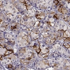 Anti-TGFBR3L Antibody