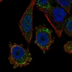Immunofluorescent staining of human cell line PC-3 shows localization to vesicles.