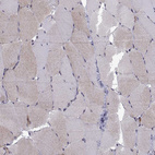 Immunohistochemical staining of human skeletal muscle shows weak cytoplasmic positivity in myocytes.