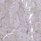 Immunohistochemical staining of human skeletal muscle shows weak cytoplasmic positivity in myocytes.