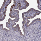 Immunohistochemical staining of human fallopian tube shows strong cytoplasmic/membranous positivity in glandular cells.
