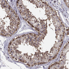 Immunohistochemical staining of human testis shows strong membranous/cytoplasmic positivity in spermatogonia.