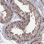 Immunohistochemical staining of human testis shows strong membranous/cytoplasmic positivity in spermatogonia.